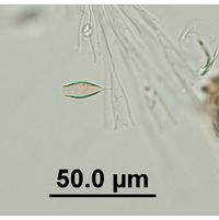 Epipyxis utriculus