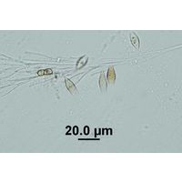 Epipyxis utriculus