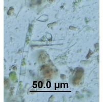 Epipyxis sp. 
