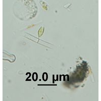Epipyxis sp. 