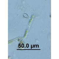 Epipyxis utriculus 
