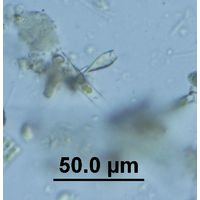 Epipyxis utriculus