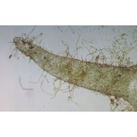 Hydrurus foetidus