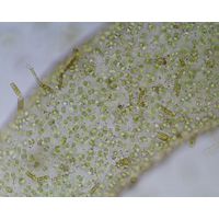 Hydrurus foetidus