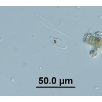 Mallomonas cf. allorgei