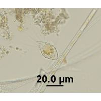 Mallomonas sp. 