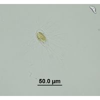 Mallomonas sp.