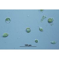 Mallomonas sp.  