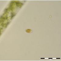 Mallomonas sp. 