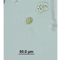 Mallomonas sp. 