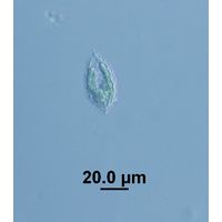Mallomonas sp. 