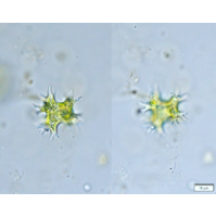 Pseudostaurastrum enorme