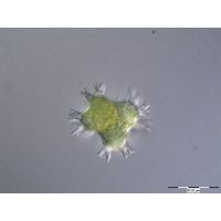 Pseudostaurastrum enorme