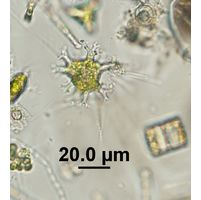 Pseudostaurastrum enorme
