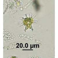 Pseudostaurastrum enorme
