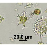 Pseudostaurastrum enorme
