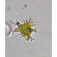 Pseudostaurastrum enorme