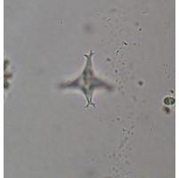 Pseudostaurastrum limneticum