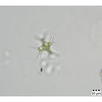 Pseudostaurastrum limneticum