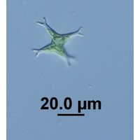 Pseudostaurastrum limneticum