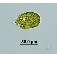 Gonyostomum sp.