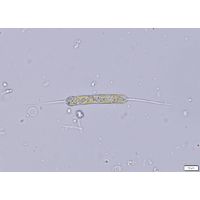 Centritractus