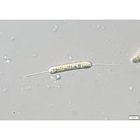 Centritractus