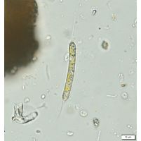 Centritractus