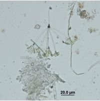Ophiocytium arbuscula