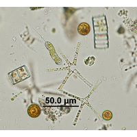 Ophiocytium capitatum