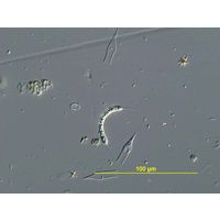 Ophiocytium