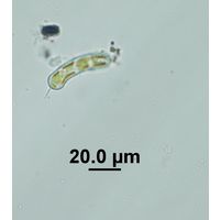 Ophiocytium cochleare