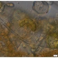 Ophiocytium capitatum