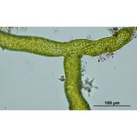 Vaucheria sessilis