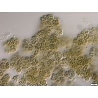 Nostoc