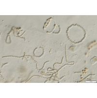 cf. Nostoc
