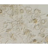 cf. Nostoc