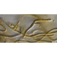 cf. Scytonematopsis