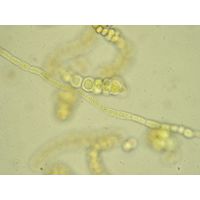Westiellopsis