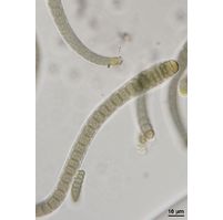 Microchaete