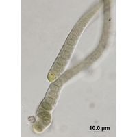 Microchaete