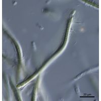cf. Calothrix