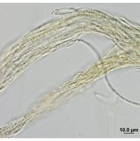 Pseudophormidium