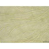 Calochaete
