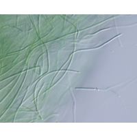Oculatella