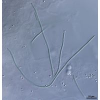 cf. Oculatella