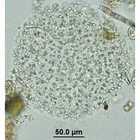 Aphanocapsa grevillei