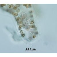 Aphanocapsa parasitica