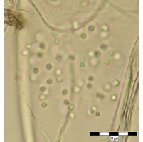 Aphanocapsa venezuelae