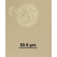 Aphanocapsa planctonica